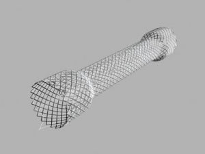 Evolution® Esophageal Controlled-release Stent - Fully Covered, 1 Each