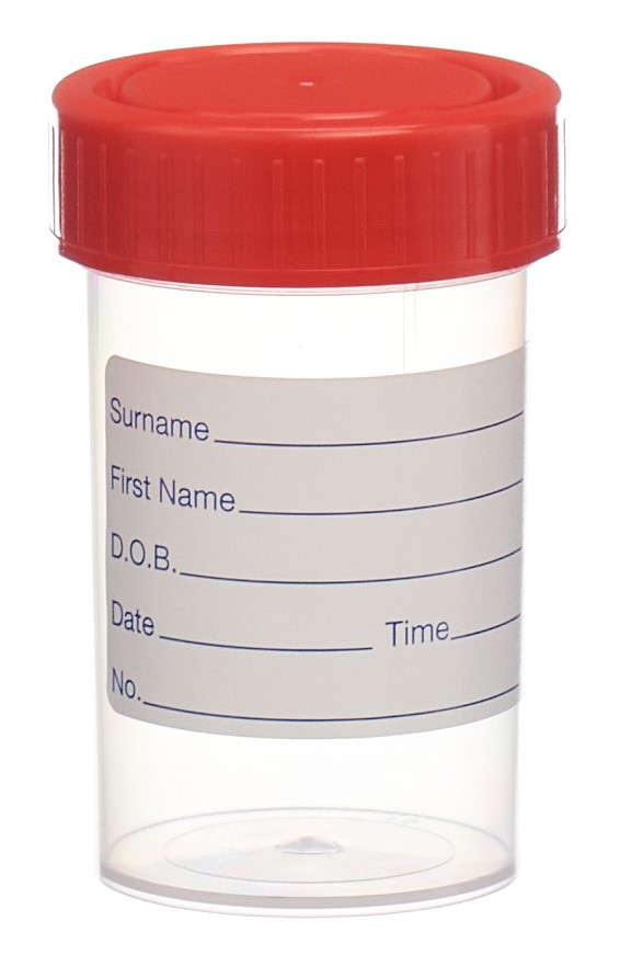 FONTE Urinbehälter 60ml steril