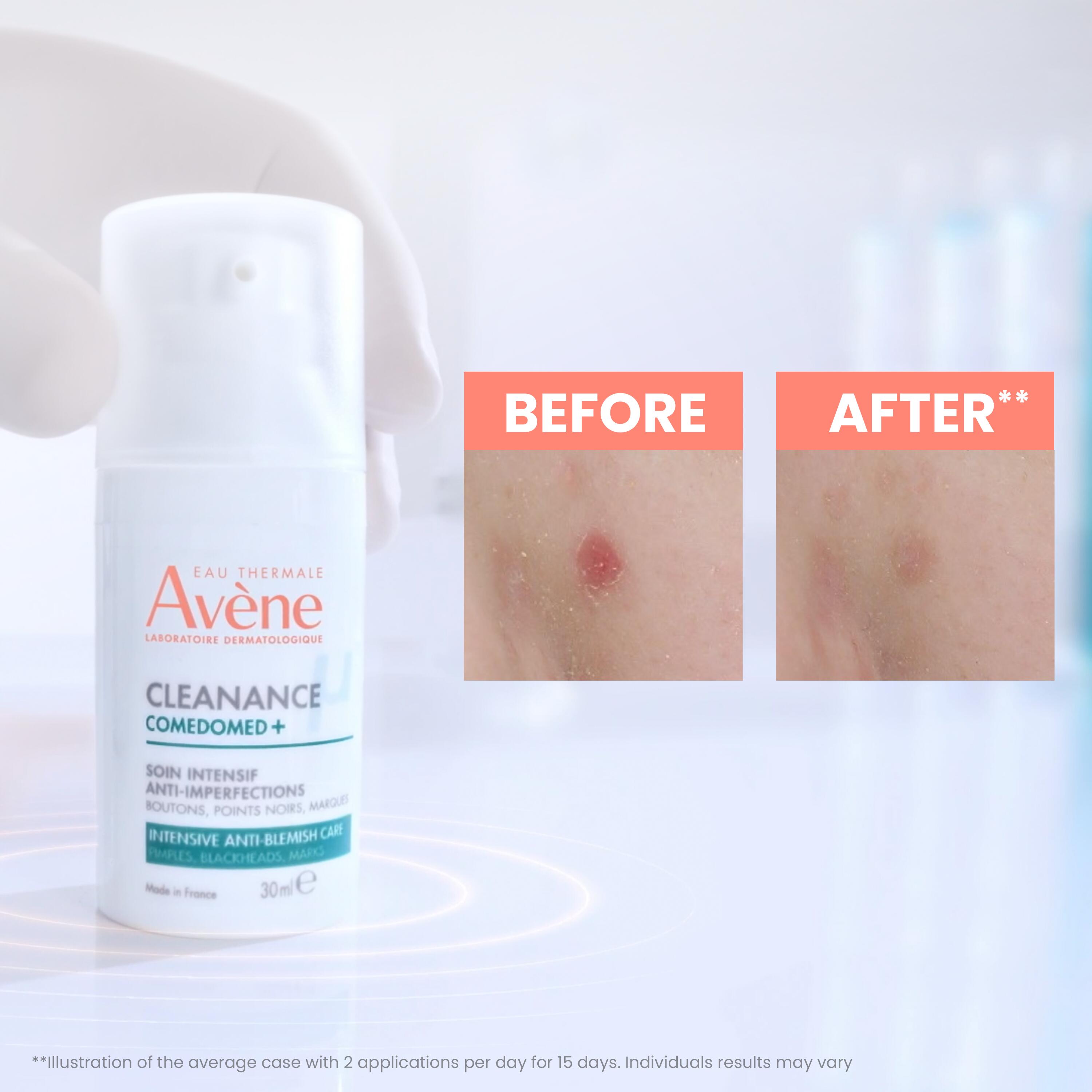 AVENE Cleanance Comedomed+ int Konz 30 ml