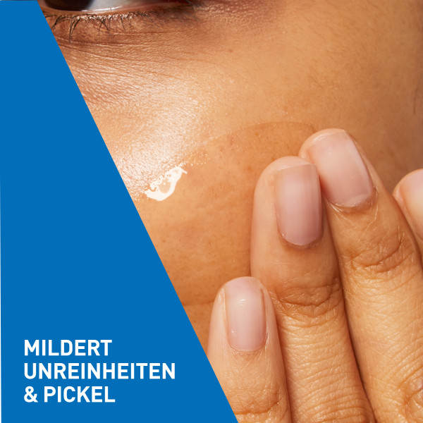 CERAVE Anti-Unreinheiten Gel Tb 40 ml