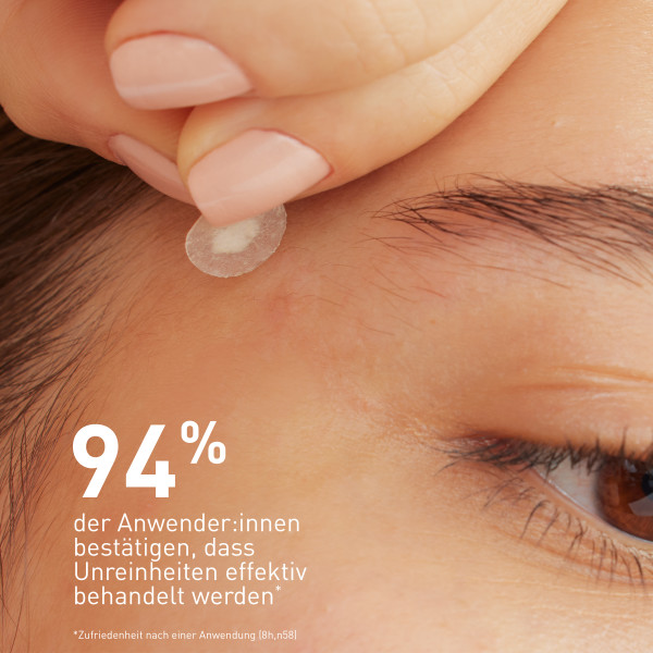 CERAVE Anti-Unreinheiten Patches 22 Stk