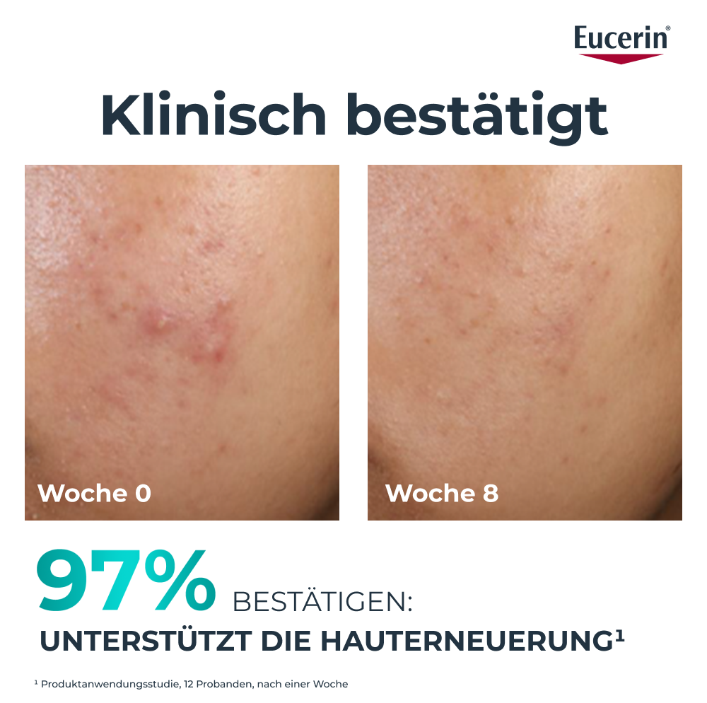 EUCERIN Dermopure Clin Peel 10 Nachtp hautbi 40 ml
