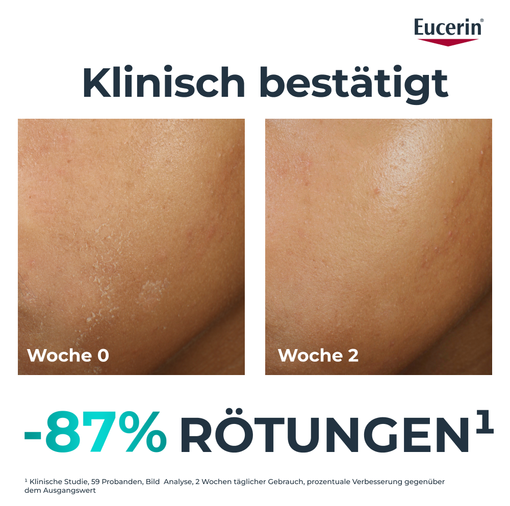 EUCERIN Dermopure Clin Feuchtigkeitspfl ther 40 ml
