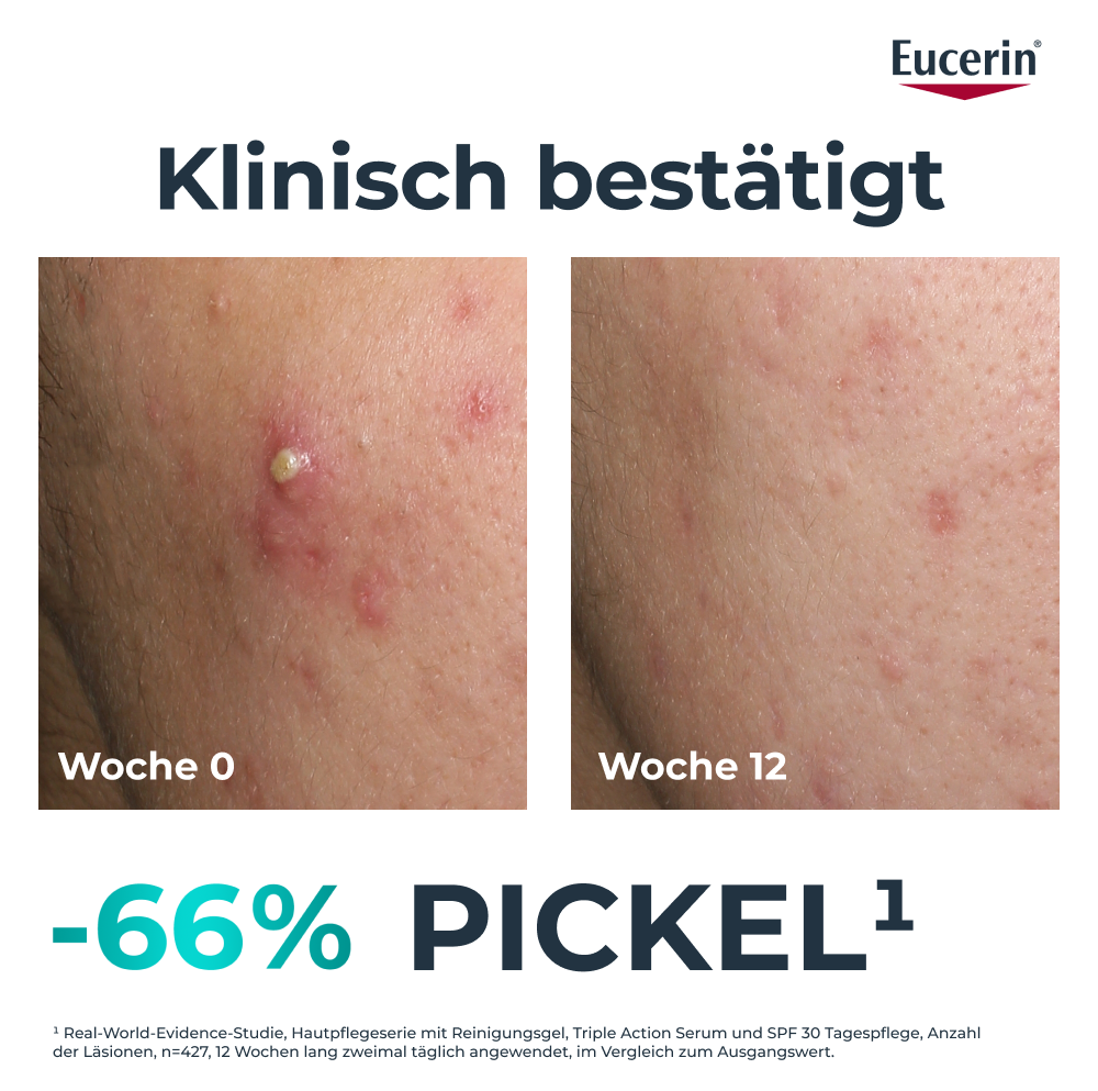 EUCERIN Dermopure Clin Pflege 3-fach tiefenw 40 ml