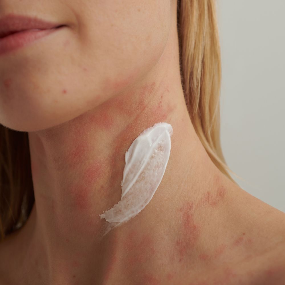 DADO SENS Extroderm Intensiv Creme (n) 50 ml