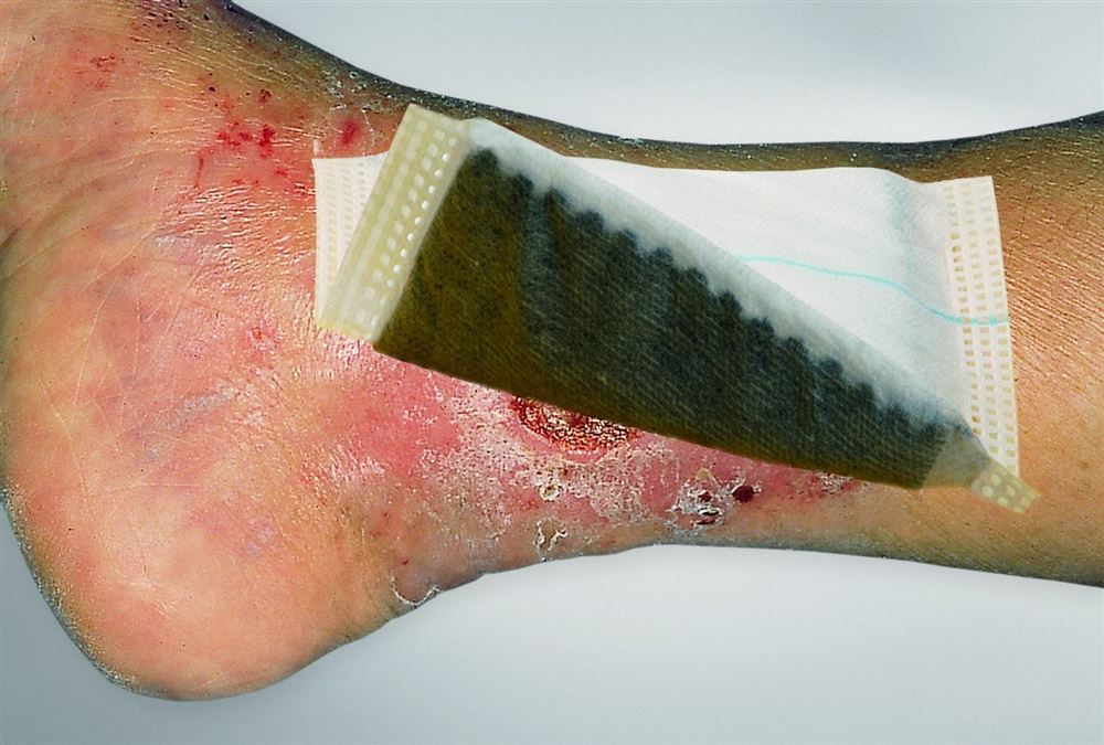 VLIWAKTIV Ag Aktivkohle Verband 10x20cm ste 10 Stk