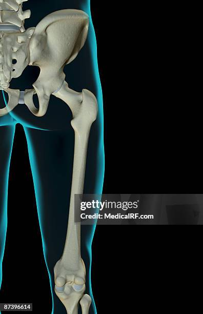 Hook for Obturator Foramen