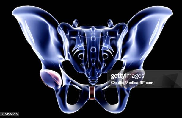 Hook for Obturator Foramen