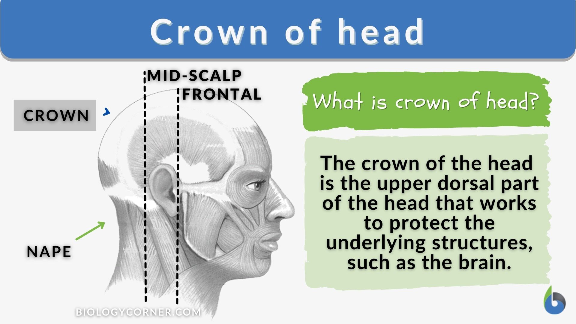 Head Pin