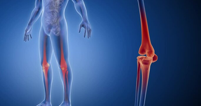 Patella Sizer