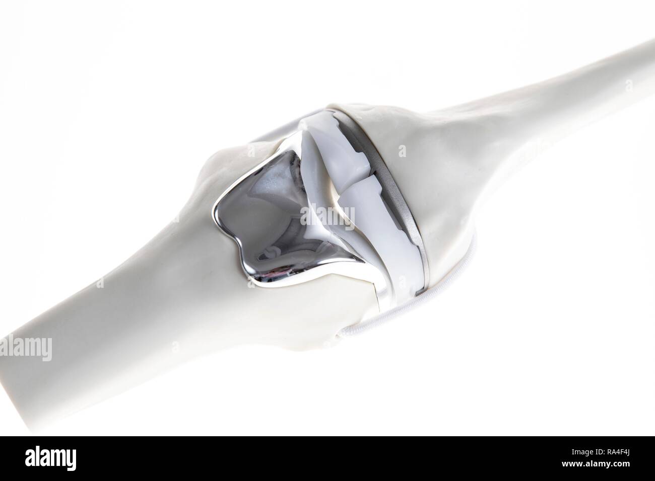 Knee-Joint Prosthesis
