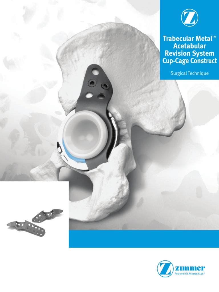 Additional Instrument Set for T.O.P. Acetabular Cup System (Trial Inserts, Inner-Ø 32 mm)