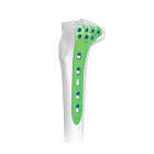 Proximal Tibial Replacement Component