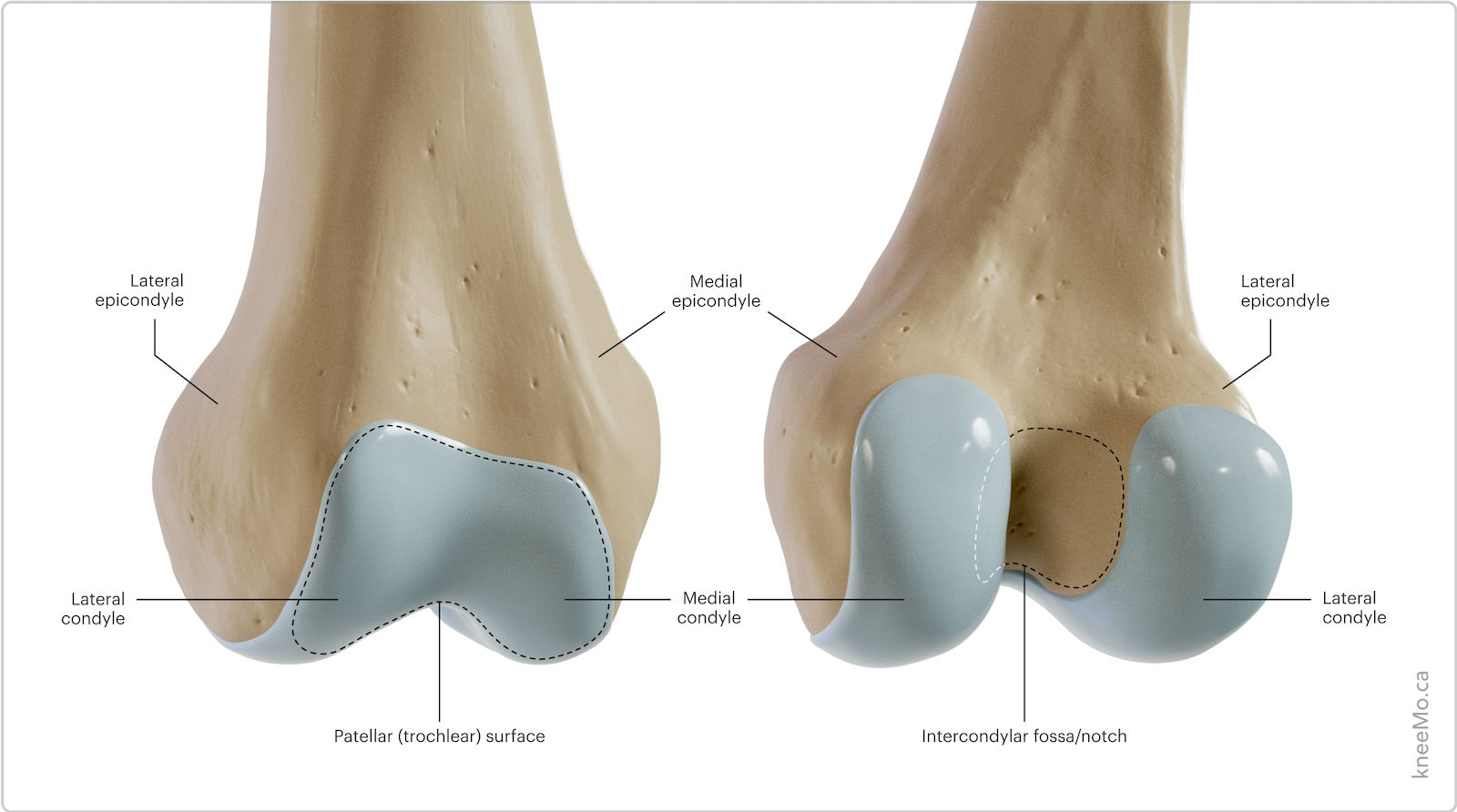 Condyle Cap