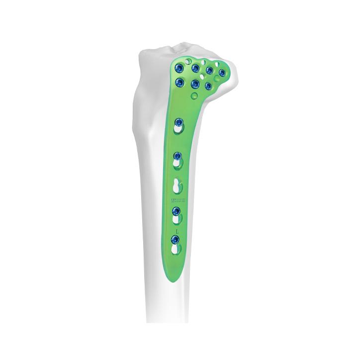Tibial Trial Plate