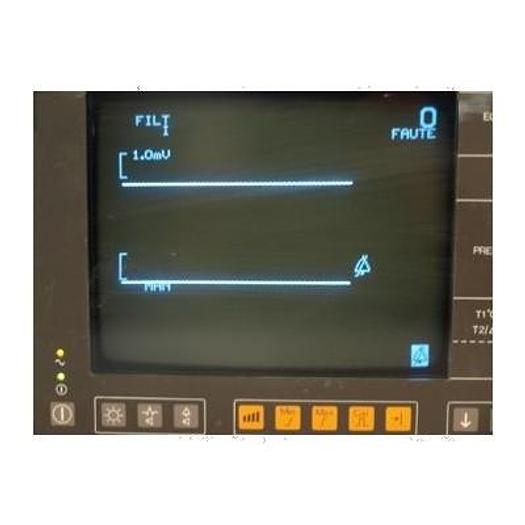 PRO-CART 35U KU-5576-902 SINGLE MONITOR