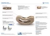 LOOP M-09-06 T-LIF CAGE 9 X37MM 6 DEG