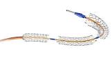 ARCH SLOW DEG STENT 10FR6CM BPS34060S