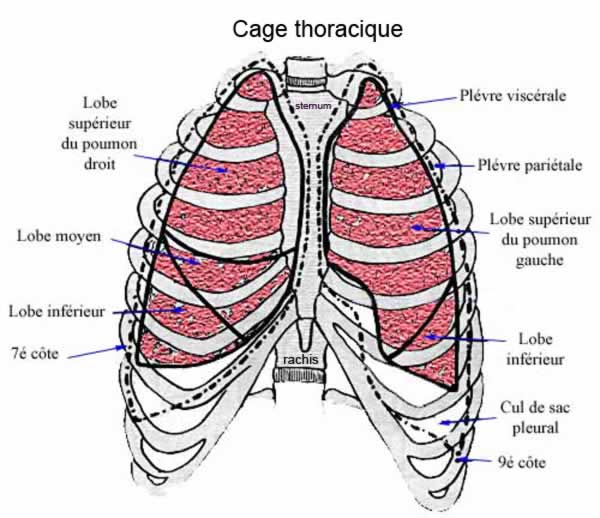 CAGE X3832746 PSR PK ANAT CAGE 14X17X6