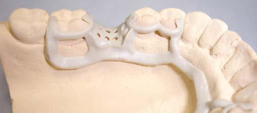 CAGE 6211807 PEEK ANATOMIC 18X16X7