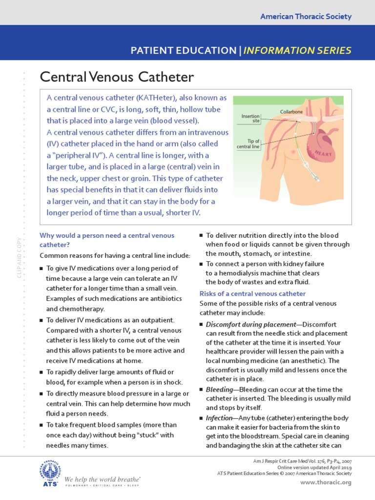 MAPPING CATHETER ACHIEVE ST 25MM