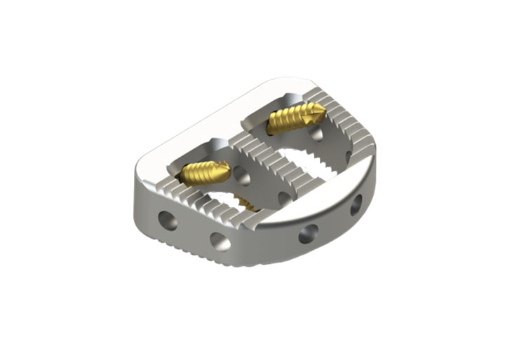 CAGE 369121610 MEDIUM TI ALIF 16DEGX10MM