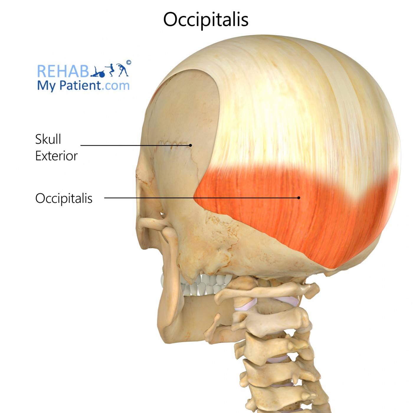 OCCIPITAL 3600211 PRE CURVED CCM 3.5X200