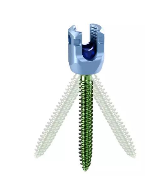 SET SCREW 6540530 5.5/6.0 SOLERA VOYAGER