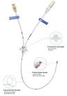 KIT SVC O2 BI71000551 CASTER CBLE PUSHER