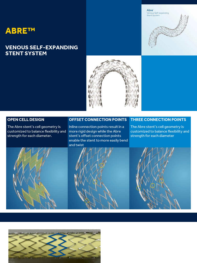 STENT AB9G20150090 ABRE
