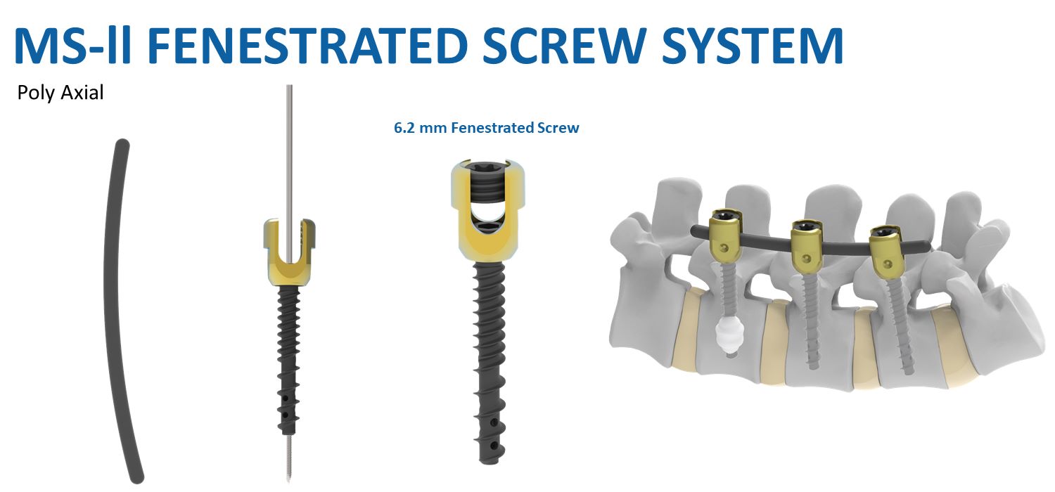 CEMENT 7480724 FENESTRATED SCREW PMMA