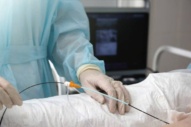 ABLATION DEVICE 49260 PROCEDURE KIT