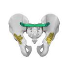 CONNECTOR 8614110 SACRAL ILIO PLATE