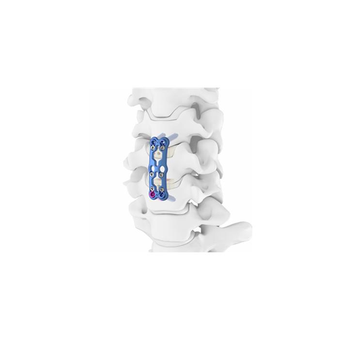 PLATE 876-127 27.5MM ANTERIOR CERVICAL