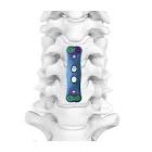 PLATE 876-135 35MM ANTERIOR CERVICAL