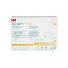 MESH 905-903  PYRM  19 X 150 ANGLED