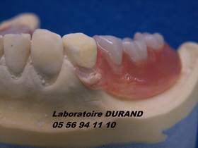 PROSTHESIS 0520 FLEX H/A NOTCHED OFFSET