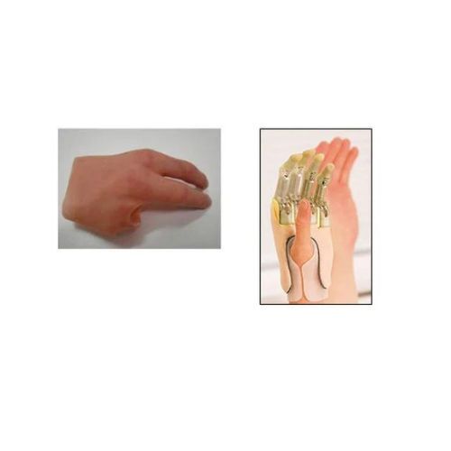 PROSTHESIS 1112090 H/A PARTIAL 90DEG ROU