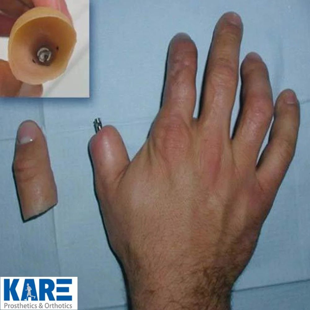 PROSTHESIS 1112095 H/A PARTIAL 90DEG OFF