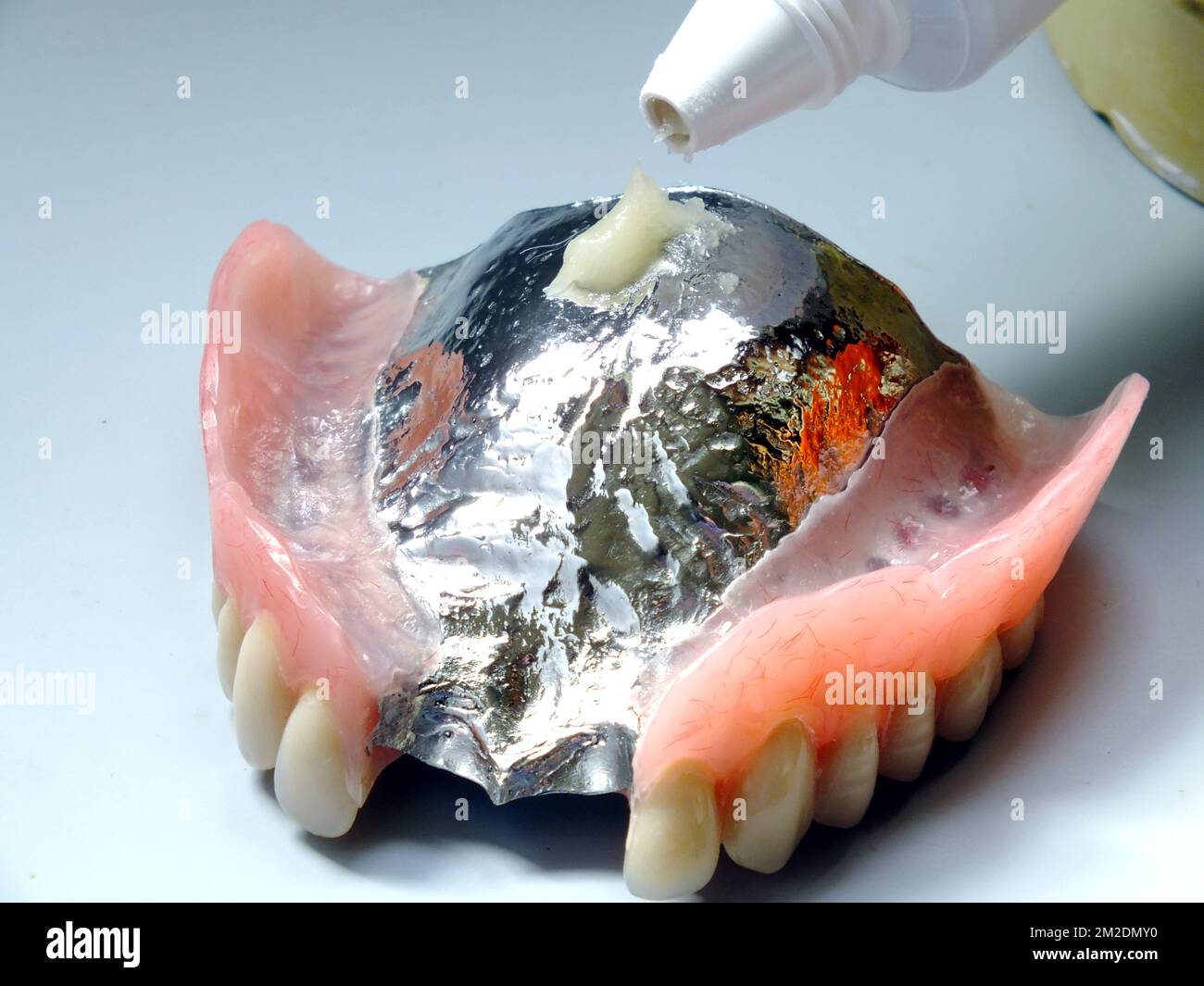 PROSTHESIS 1156307 FISCH TOTAL 8MM L