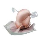 MESH 9052270  PYRM IMPLANT 22MMX70MM RND