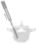 INSTRUMENT 836-061 TSRH 3D VBR RDCT PLRS