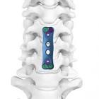PLATE 976-150 50MM ANTERIOR CERVICAL