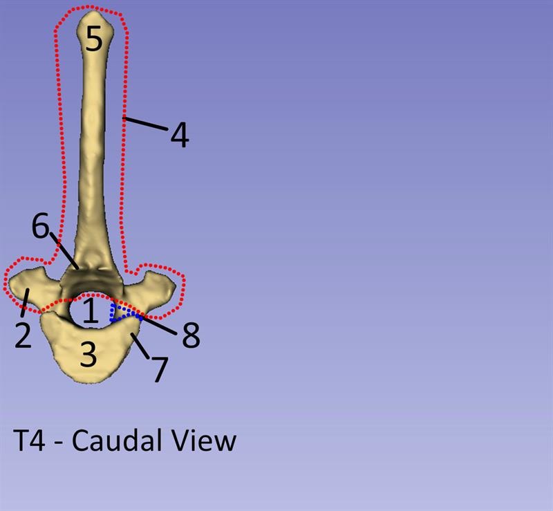 STAPLE 9330002  THORACIC CAUDAL TI