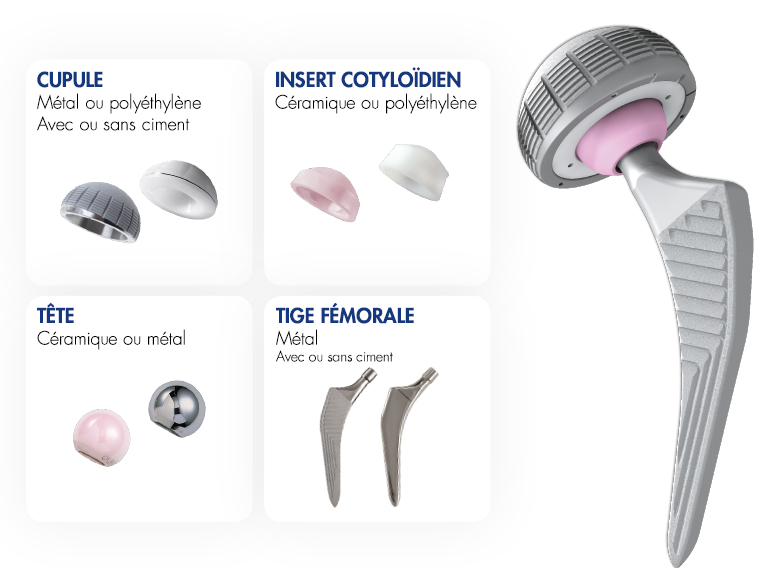 PROSTHESIS 1156601 PLAT/TI .5MMX4MM