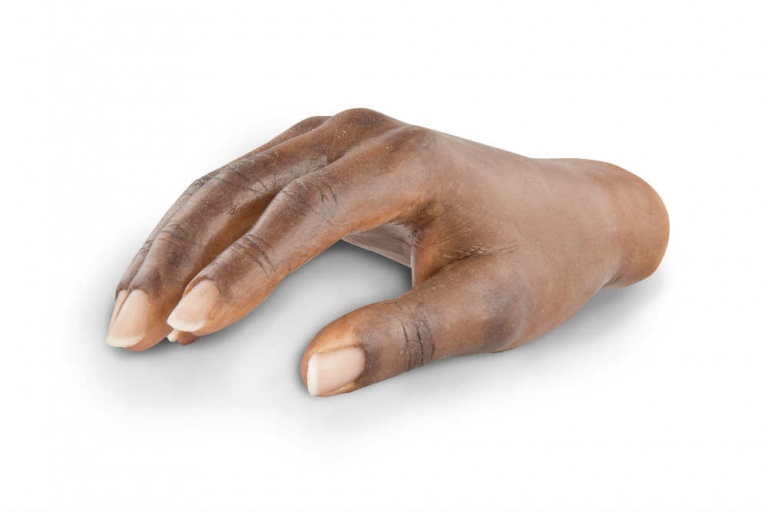 PROSTHESIS 1156602 PLAT/TI .5MMX4.25MM
