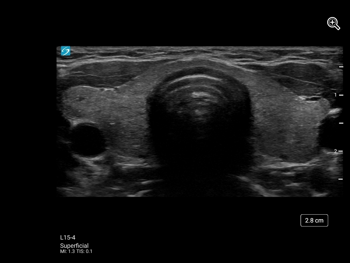 BLOCK 9732134 SONOSITE VERIFICATION