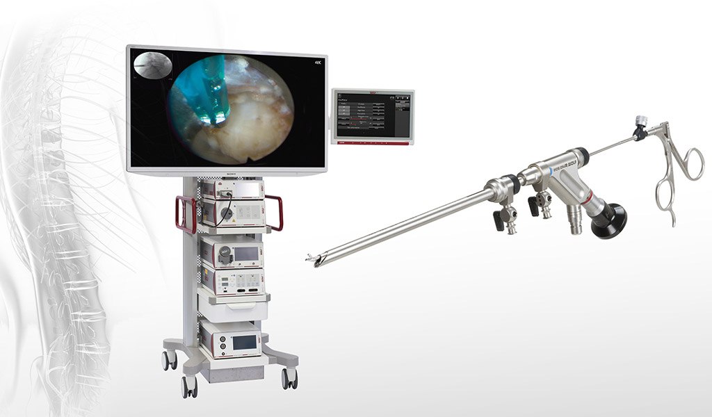 PROBE 9734434 LEFT LUMBAR TACTILE