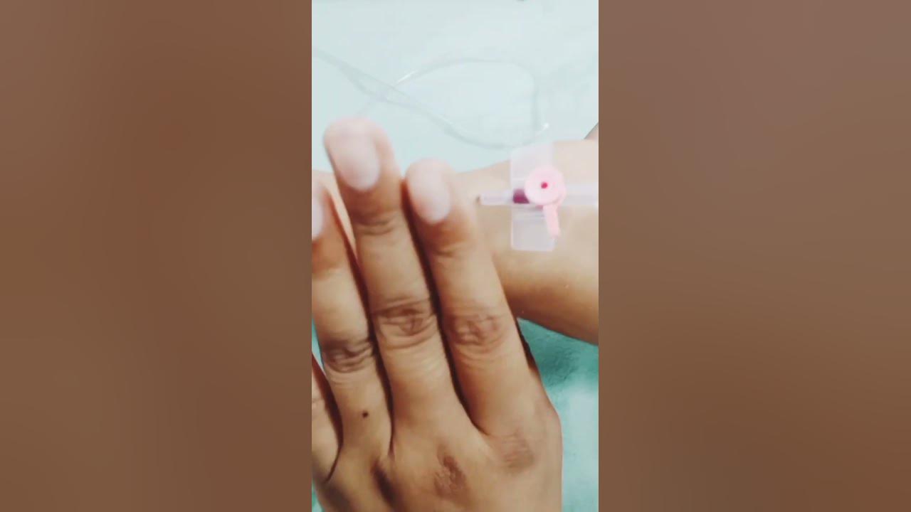 CANNULA CB68118 SS VEN MALL 18FR CARMEDA