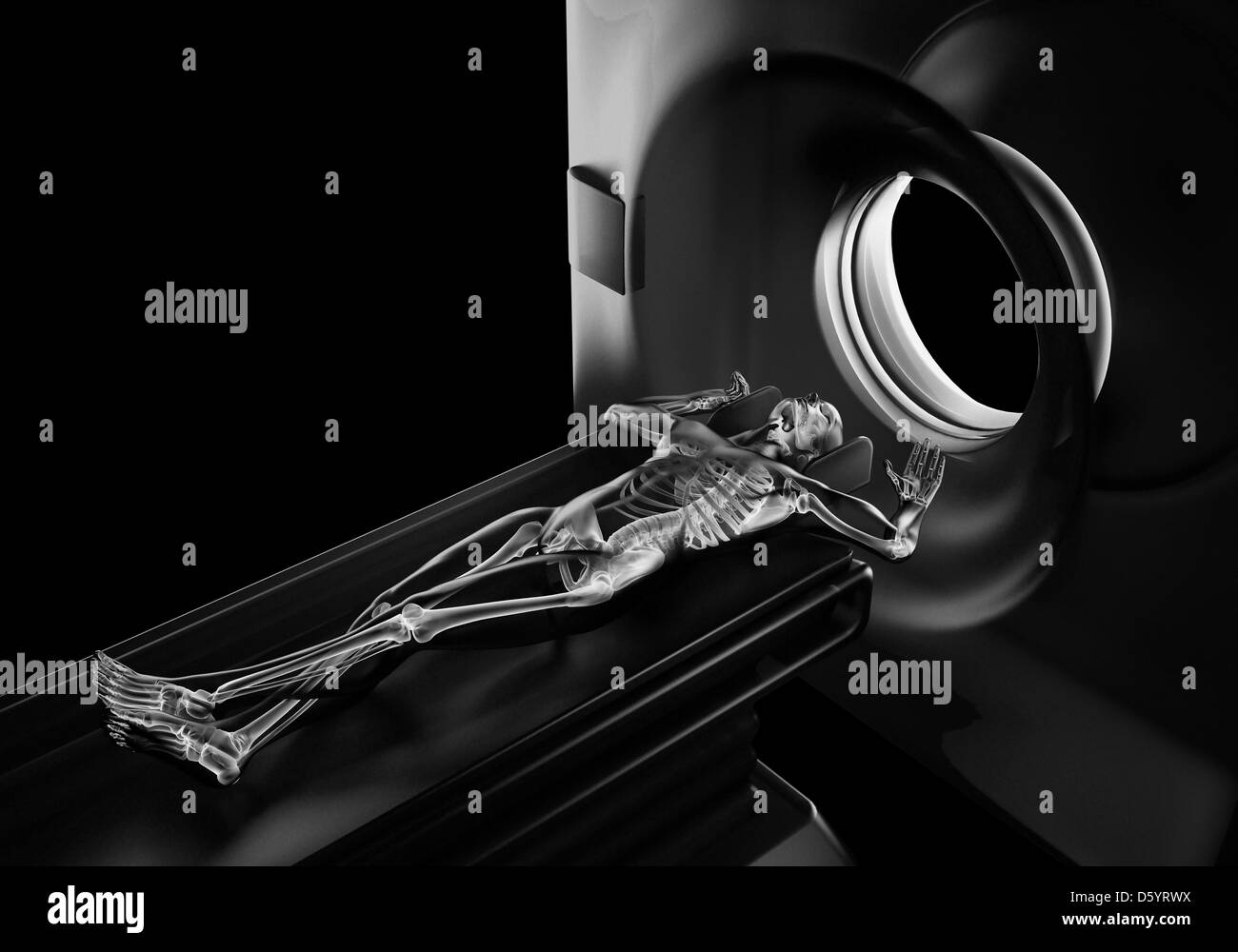 CRTD DTMB2QQ AMPLIA MRI QUAD OUS DF4